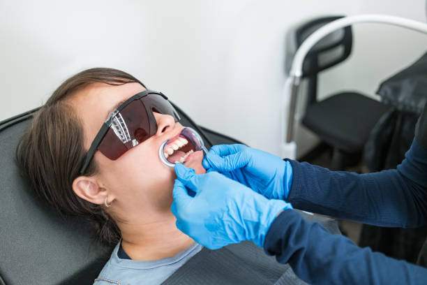 Best Broken or Chipped Tooth Repair in Dianapolis, IN